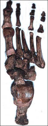 The introduction of sturdy shoes led weaker toes.