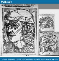  Johann Dryander, one of the first German doctors to perform public disections, published his 'Anatomia Capitis Humani' in 1536, which contained the most extensive study on the human head to date, and the first 'Galenic dissection' of the brain.  (View Larger)